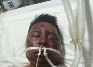 Así termino el ladron se la combi.