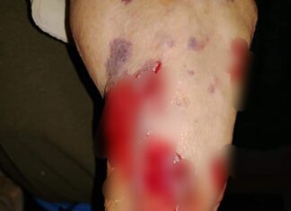 Jauría de perros ataca a adulto mayor en Los Pastitos, en Yuriria.