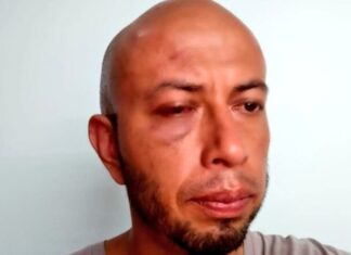 Vinculan a proceso a policías de Silao involucrados en golpiza al reportero Carlos García.