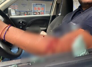 Agreden a camarógrafo de MEGANOTICIAS en la.colonia Benito Juárez, en Salamanca.