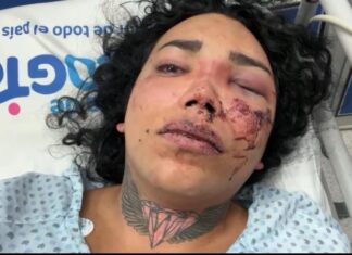 Golpean salvajemente a la influencer Paola Suárez; señala a su prometido