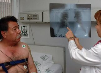 Atiende IMSS Guanajuato EPOC en sus tres niveles de atención